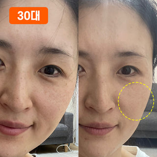 🤍지인언니 전용🤍 누구나 옅어질 수밖에 없는! 들깨기미크림 80g 2개입 SET (~84%)