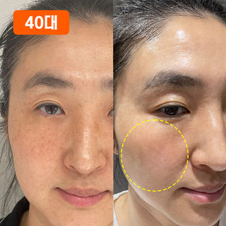🤍지인언니 전용🤍 누구나 옅어질 수밖에 없는! 들깨기미크림 80g 2개입 SET (~84%)