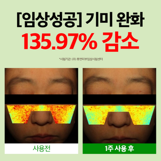 🤍지인언니 전용🤍 누구나 옅어질 수밖에 없는! 들깨기미크림 80g 2개입 SET (~84%)